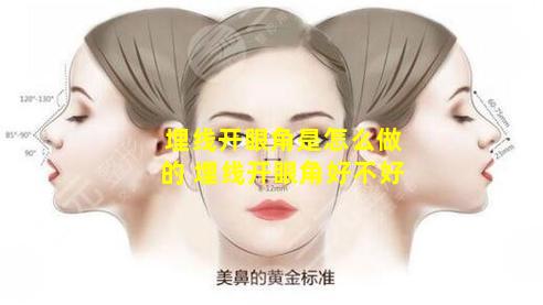 埋线开眼角是怎么做的 埋线开眼角好不好